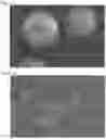 Fig. 02 - VINYL-BASED RESIN PARTICLES AND METHOD FOR MANUFACTURING SAME