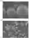 Fig. 06 - VINYL-BASED RESIN PARTICLES AND METHOD FOR MANUFACTURING SAME