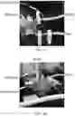 Fig. 37 - ACOUSTIC PERFUSION DEVICES