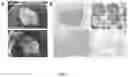 Fig. 06 - Macrotumor engineering