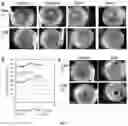 Fig. 07 - Macrotumor engineering