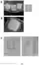 Fig. 08 - Macrotumor engineering