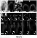 Fig. 08 - Methods for forming three-dimensional human retinal tissue in vitro