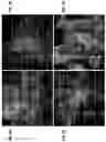 Fig. 04 - MORPHOGENIC COMPOUND-RELEASING MICROSPHERES AND USE IN BIOINK