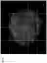 Fig. 33 - MORPHOGENIC COMPOUND-RELEASING MICROSPHERES AND USE IN BIOINK