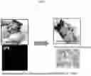 Fig. 09 - Differentiation of pluripotent cells into microglial cells expressing IBA-1
