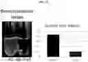 Fig. 16 - Differentiation of pluripotent cells into microglial cells expressing IBA-1