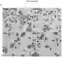 Fig. 17 - Method for differentiation of human pluripotent stem cell lines in suspension culture