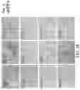 Fig. 07 - BROWN FAT CELLS AND METHOD FOR PREPARING SAME