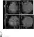 Fig. 08 - Cell Mass Fusion Method