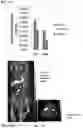 Fig. 09 - Enhanced adoptive cell therapy