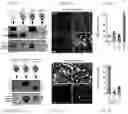 Fig. 02 - DNase therapy for intravascular accumulation of extracellular DNA