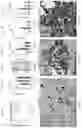 Fig. 05 - DNase therapy for intravascular accumulation of extracellular DNA