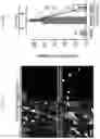Fig. 10 - DNase therapy for intravascular accumulation of extracellular DNA