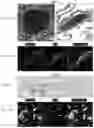 Fig. 12 - DNase therapy for intravascular accumulation of extracellular DNA