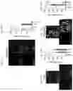 Fig. 14 - DNase therapy for intravascular accumulation of extracellular DNA