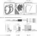 Fig. 41 - DNase therapy for intravascular accumulation of extracellular DNA