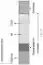 Fig. 35 - Detection of microbial endotoxins in oral samples using aptamers