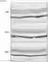 Fig. 05 - ANTISENSE OLIGONUCLEOTIDES FOR MODULATING HTRA1 EXPRESSION