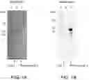 Fig. 02 - P38 map kinase inhibitors
