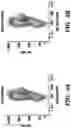 Fig. 19 - Method of reducing the effects of aging-associated impairment of neurogenesis comprising modulating c-c chemokine receptor type 3 (CCR3)