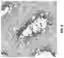 Fig. 04 - MATERIALS AND METHODS FOR PREVENTING TRANSMISSION OF A PARTICULAR CHROMOSOME