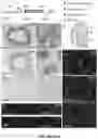 Fig. 08 - MATERIALS AND METHODS FOR PREVENTING TRANSMISSION OF A PARTICULAR CHROMOSOME