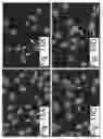 Fig. 16 - METHODS OF DETECTING NUCLEIC ACID SEQUENCES WITH HIGH SPECIFICITY