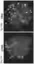 Fig. 57 - METHODS OF DETECTING NUCLEIC ACID SEQUENCES WITH HIGH SPECIFICITY
