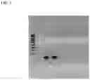 Fig. 11 - METHODS OF PREDICTING PREDISPOSITION TO OR RISK OF KIDNEY DISEASE