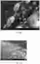 Fig. 07 - Metal matrix composite comprising nanotubes and method of producing same