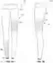 Fig. 02 - METHOD FOR MANUFACTURING KNIT ARTICLES INCORPORATING REFLECTIVE YARN AND KNIT ARTICLES