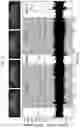 Fig. 09 - Bidirectional self-healing neural interface