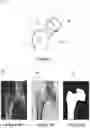 Fig. 04 - Method and system for selecting a region of interest in an image