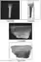 Fig. 08 - Method and system for selecting a region of interest in an image