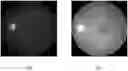 Fig. 01 - APPARATUS FOR DIAGNOSING GLAUCOMA