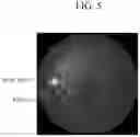 Fig. 06 - APPARATUS FOR DIAGNOSING GLAUCOMA