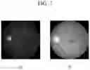 Fig. 08 - APPARATUS FOR DIAGNOSING GLAUCOMA