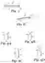 Fig. 03 - ARTIFICIAL FINGERNAIL EXTENSION