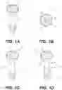Fig. 02 - Subdermal medical system for generating measurement data or providing a therapy