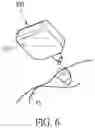 Fig. 06 - OPHTHALMIC PRODUCT WITH CORNEA REPAIR FUNCTION