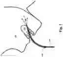 Fig. 02 - Sublingual Light Therapy Device