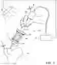 Fig. 02 - Device for improving the accuracy of manual operations