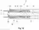 Fig. 12 - Spindle drive assembly, vehicle hatch with a spindle drive assembly and method for installing an epicyclic gearing of a spindle drive assembly