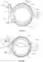 Fig. 11 - Pipe element coupler and coupling method thereof