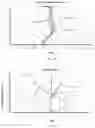 Fig. 07 - Camera optical lens including seven lenses of ++−+−−−, ++−+++− or ++−−+−− refractive powers