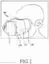 Fig. 02 - Head mounted device