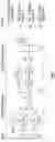 Fig. 05 - Predicting drilling tool failure