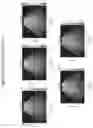 Fig. 08 - 2D shear wave dispersion imaging using a reverberant shear wave field