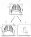 Fig. 01 - SYSTEM AND METHOD FOR IMAGE DECOMPOSITION OF A PROJECTION IMAGE